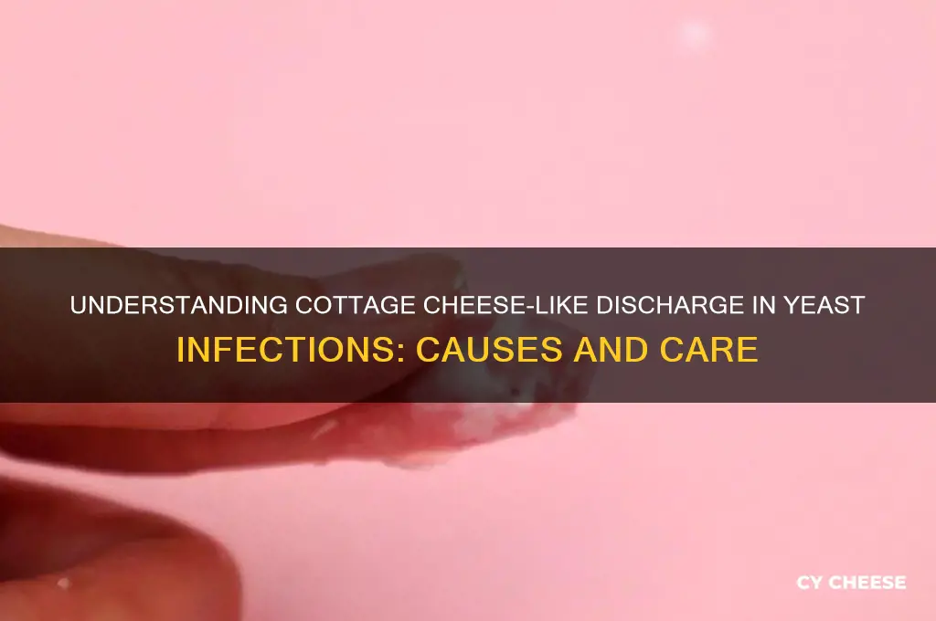 what is the cottage cheese discharge in a yeast infection