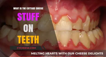 Understanding Cottage Cheese-Like Plaque Buildup on Teeth: Causes and Solutions
