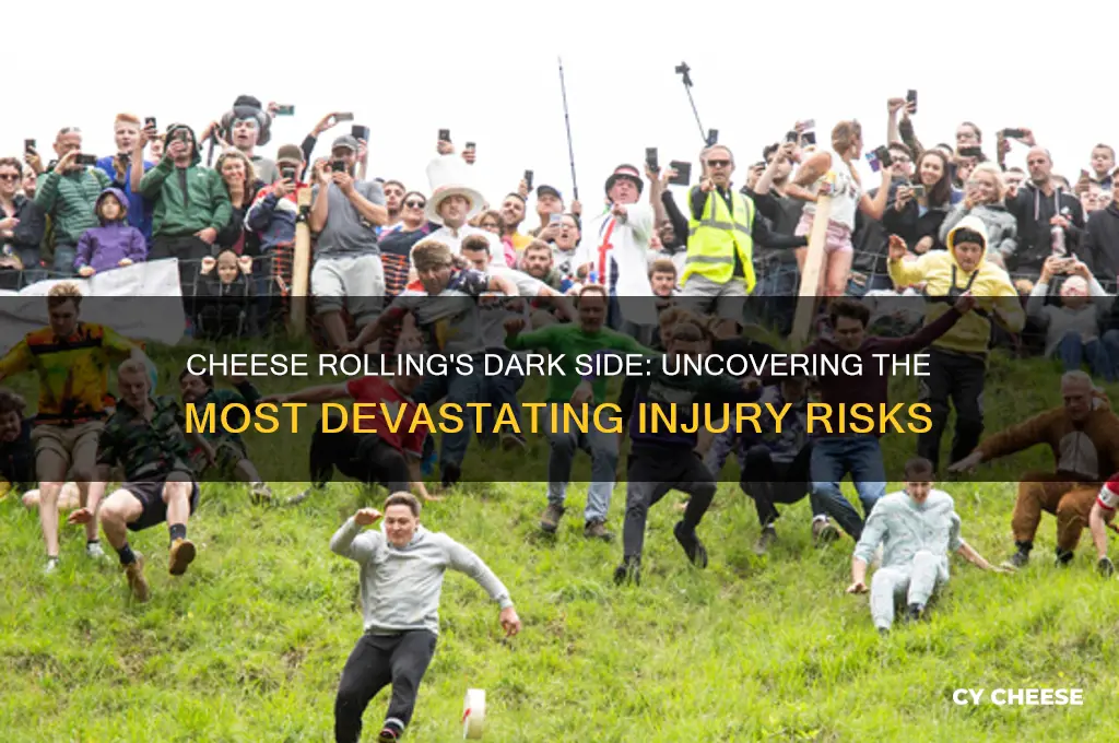 what is the worst injury in cheese rolling