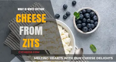 Understanding White Cottage Cheese-Like Zits: Causes, Treatment, and Prevention