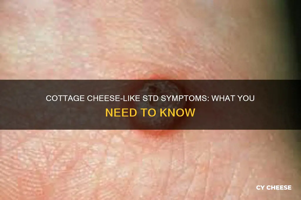 what std looks like cottage cheese