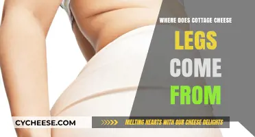 Unraveling the Origins of Cottage Cheese Legs: Causes and Solutions