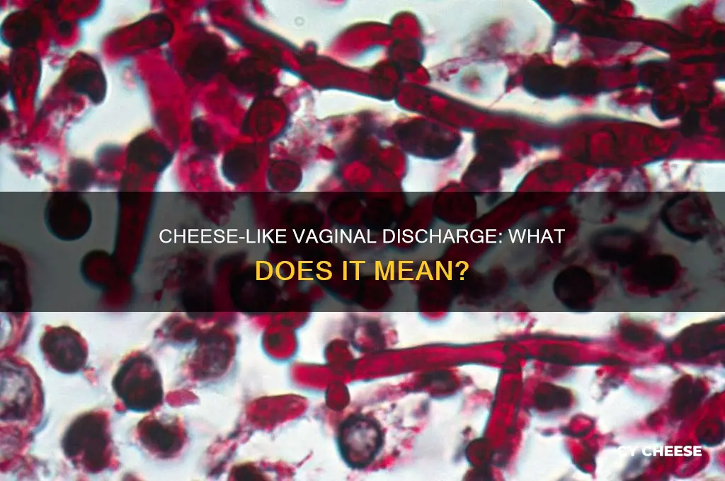 why am i having cheese like discharge