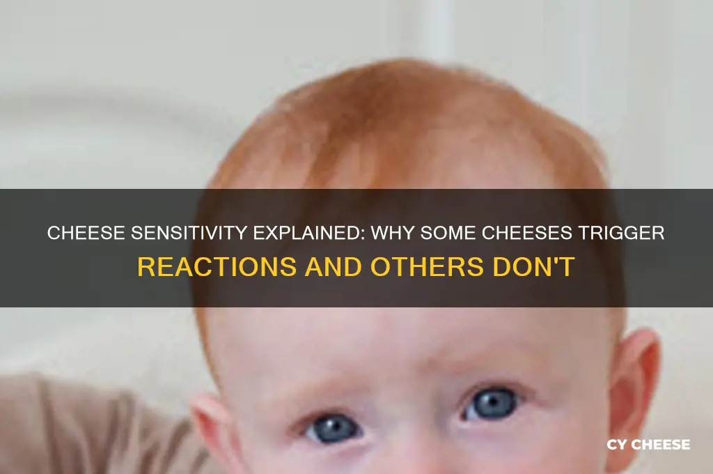 why am i sensitive to some cheeses and some now