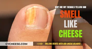 Toenail Troubles: Yellow Nails Smelling Like Cheese