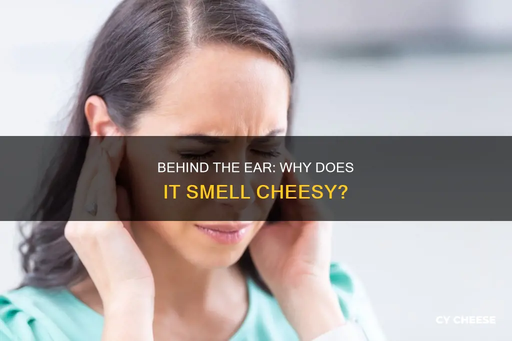 why behind ears smell like cheese