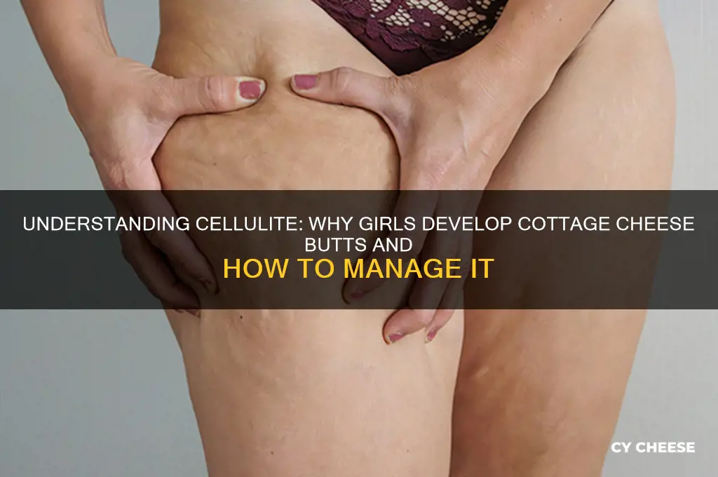 why do girls get cottage cheese butts