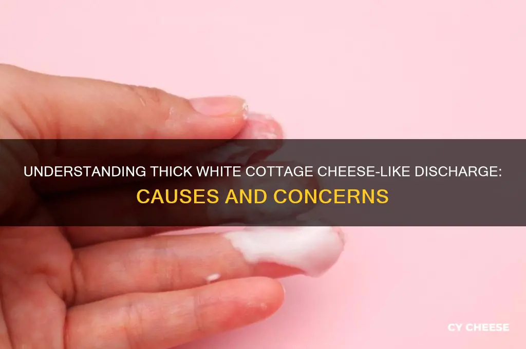 why do i have thick white cottage cheese discharge
