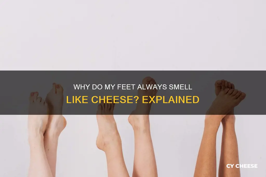 why do my feet always smell of cheese