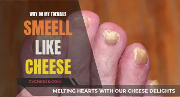 Toenail Troubles: A Cheesy Odor Mystery