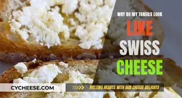 The Swiss Cheese Tonsil Mystery: What's Going On?