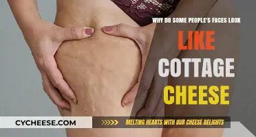 Cottage Cheese Complexion: Unraveling the Mystery Behind Textured Skin