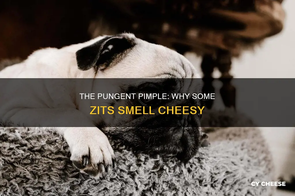 why do some pimples smell like cheese
