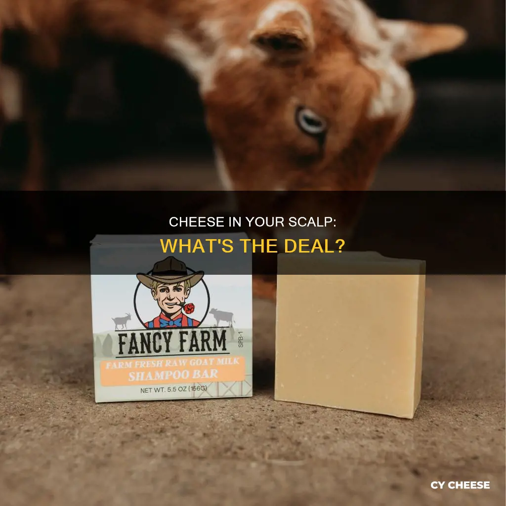 why do we get cheese in our scslp