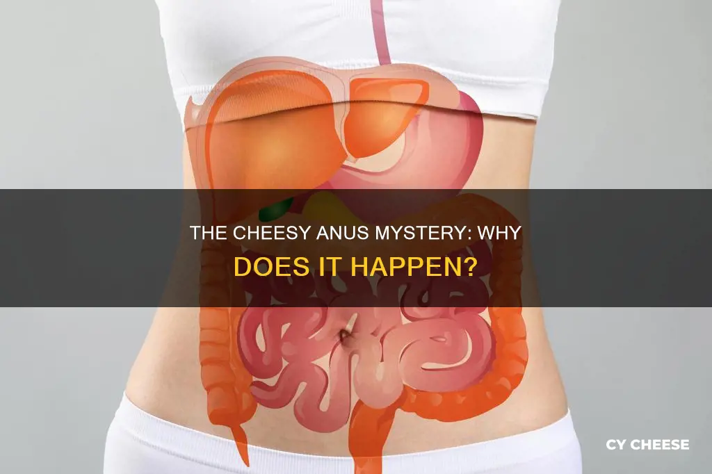 why does anus smell like cheese