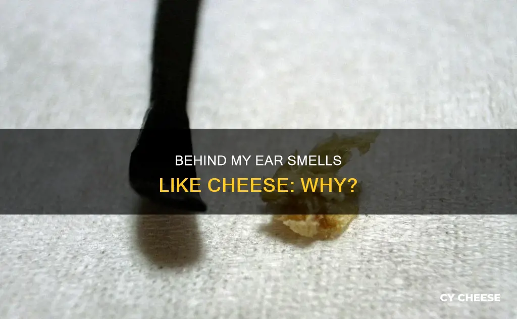 why does behind my ear smell like cheese