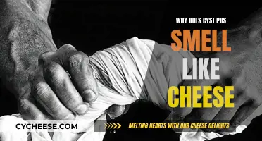 Cyst Pus: Why Does It Smell Like Cheese?