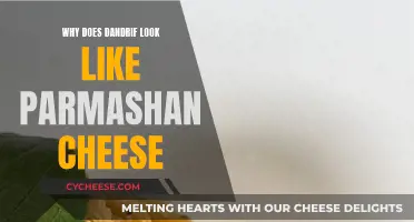 Dandruff: Parmesan Cheese Look-alike, Why?