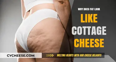 Why Does Fat Look Like Cottage Cheese? Understanding Cellulite's Texture