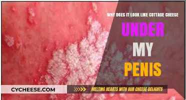 Understanding Cottage Cheese-Like Appearance Under the Penis: Causes and Solutions