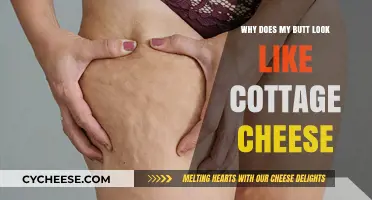 Cottage Cheese Butt: Understanding and Treating Cellulite on Your Rear