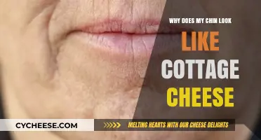 Cottage Cheese Chin: Causes and Solutions for Textured Skin