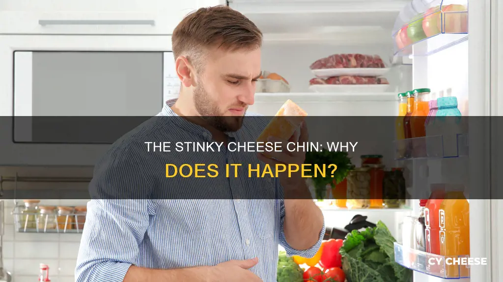 why does my chin smell like cheese
