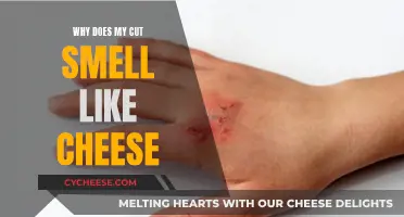 The Stinky Wound: Why Your Cut Smells Like Cheese