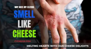 The Mystery of Cheesy-Smelling Eczema: What's the Cause?