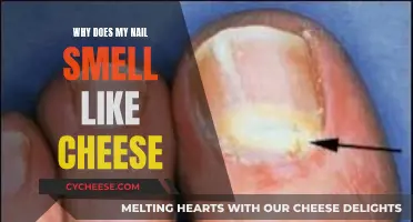 The Mystery of Cheesy-Smelling Nails: A Medical Concern