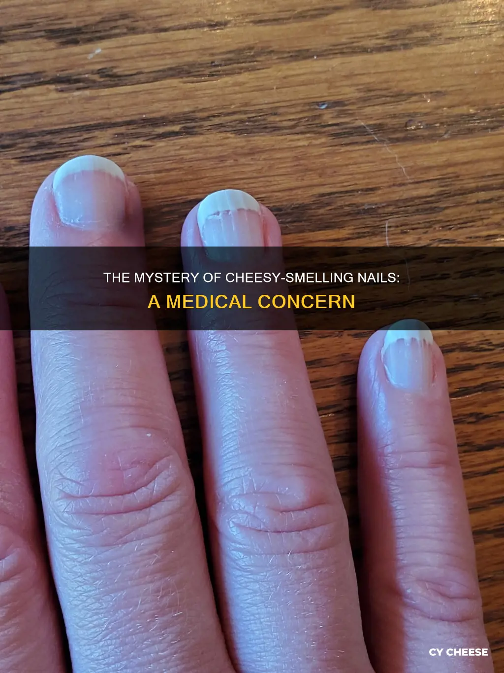 why does my nail smell like cheese