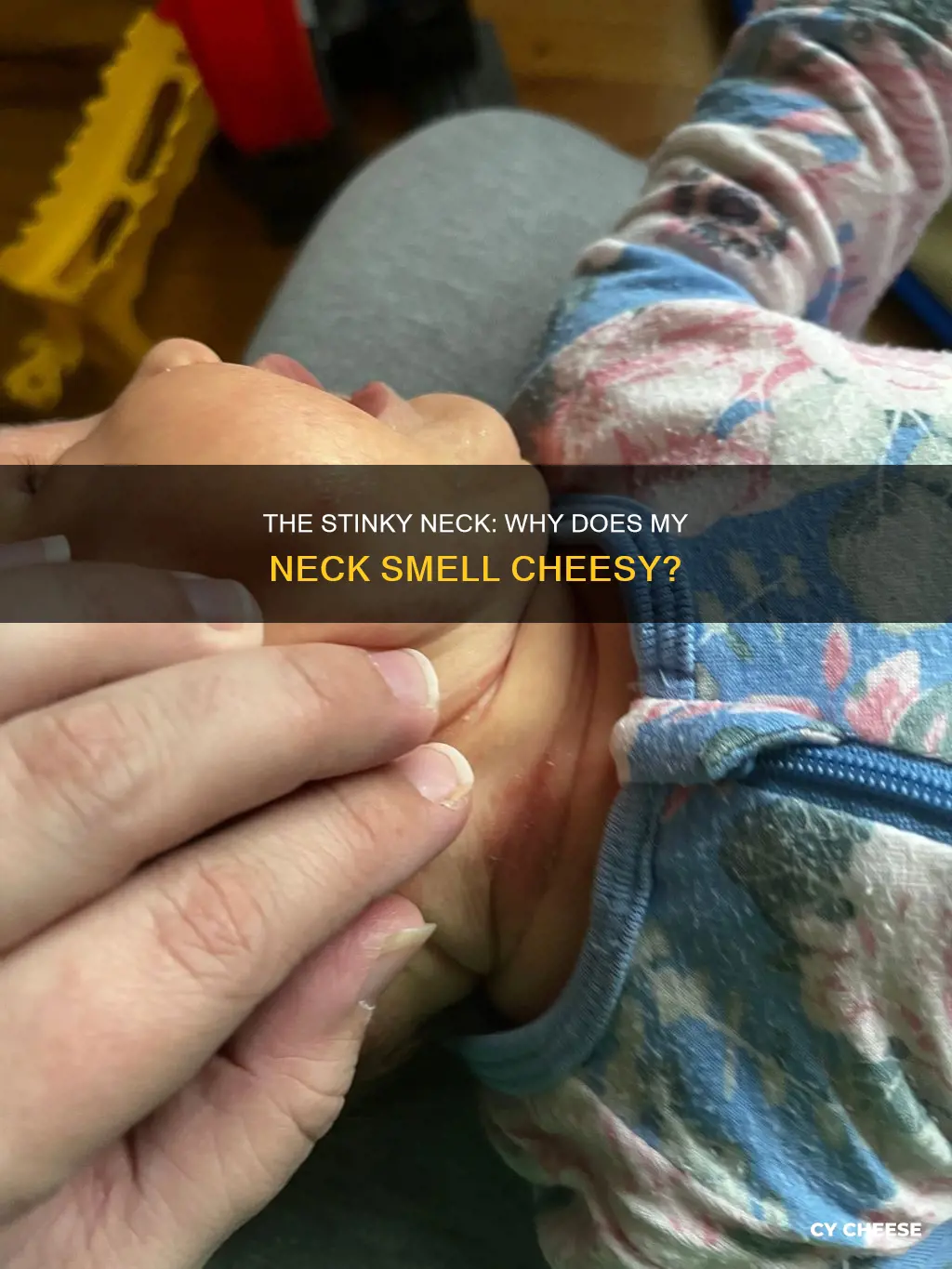 why does my neck smell like cheese