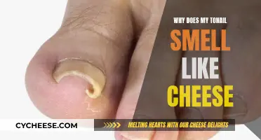 The Mystery of Cheesy Toenails: Causes and Cures
