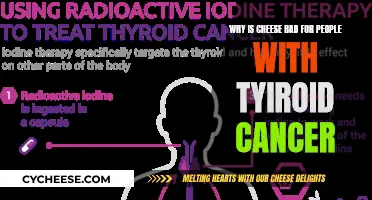 Cheese and Thyroid Cancer: A Dangerous Combination