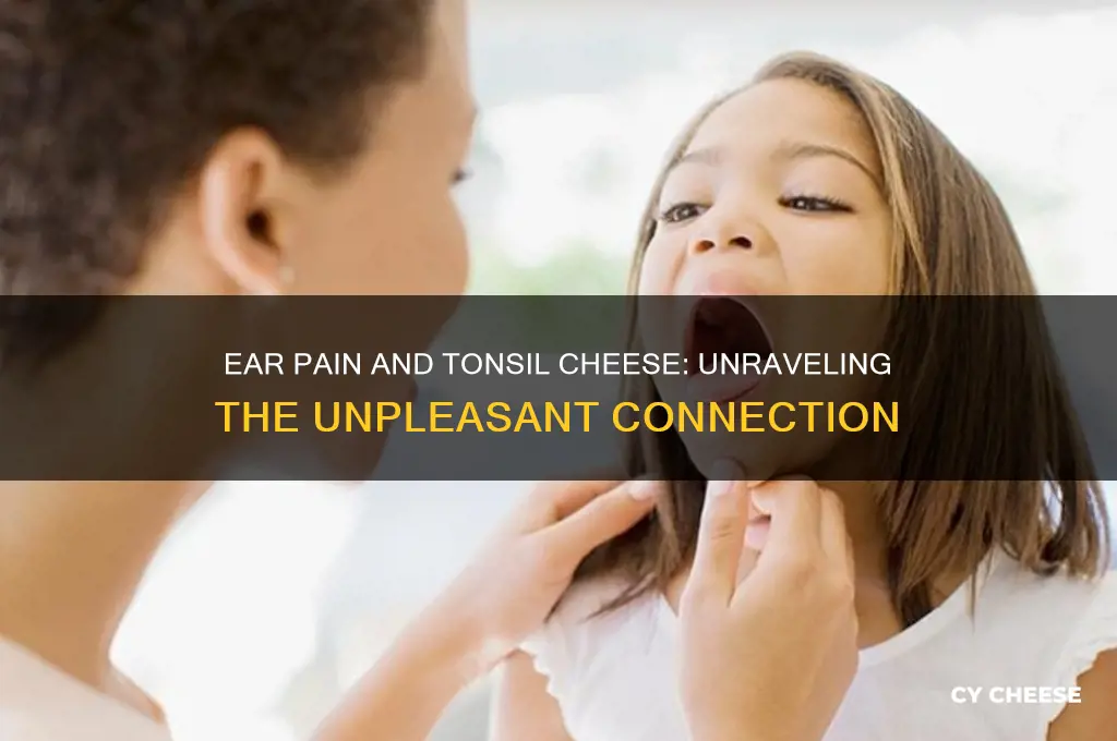 why is tonsil cheese worse when my ears hurt