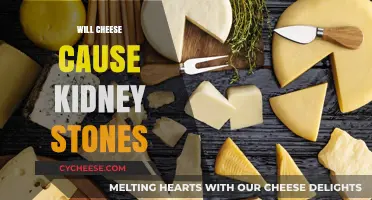 Cheese and Kidney Stones: Unraveling the Dietary Connection and Risks