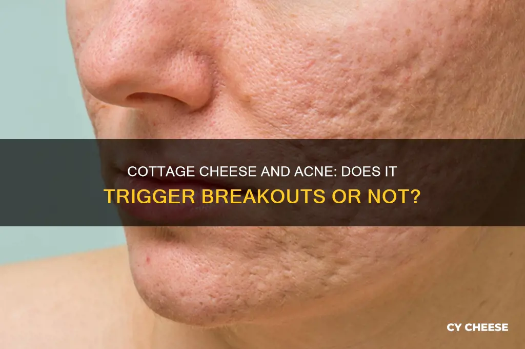 will cottage cheese make you break out